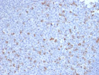 Anti-PDCD1 / PD1 / CD279 (Programmed Cell Death 1) Monoclonal Antibody(Clone: PDCD1/2720)