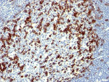 Anti-PDCD1 / PD1 / CD279 (Programmed Cell Death 1) Monoclonal Antibody(Clone: NAT105)