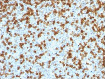 Anti-PDCD1 / PD1 / CD279 (Programmed Cell Death 1) Monoclonal Antibody(Clone: PDCD1/1410R)