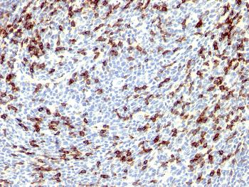 Anti-PDCD1 / PD1 / CD279 (Programmed Cell Death 1) Polyclonal Antibody