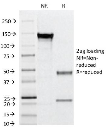 Anti-CD31 / PECAM-1 (Endothelial Cell Marker) Monoclonal Antibody(Clone: C31.12)