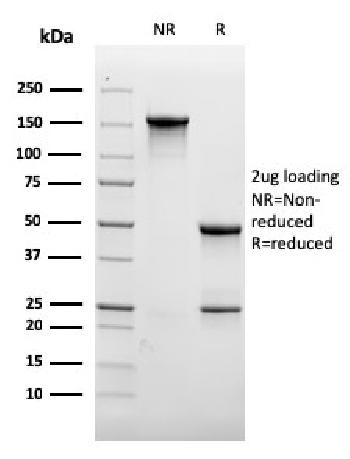 Anti-CD31 / PECAM-1 (Endothelial Cell Marker) Monoclonal Antibody(Clone: rC31.3)