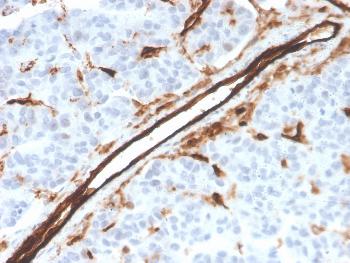 Anti-CD31 / PECAM-1 (Endothelial Cell Marker) Monoclonal Antibody(Clone: PECAM1/3526)