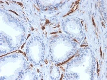 Anti-CD31 / PECAM-1 (Endothelial Cell Marker) Monoclonal Antibody(Clone: PECAM1/3527)