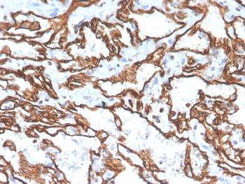 Anti-CD31 / PECAM-1 (Endothelial Cell Marker) Monoclonal Antibody(Clone: PECAM1/3529)