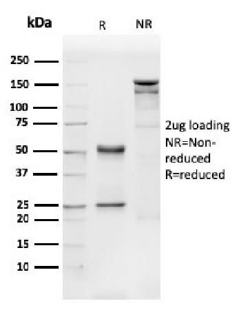 Anti-CD31 / PECAM-1 (Endothelial Cell Marker) Monoclonal Antibody(Clone: PECAM1/3540)