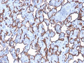 Anti-CD31 / PECAM-1 (Endothelial Cell Marker) Monoclonal Antibody(Clone: C31/2876R)