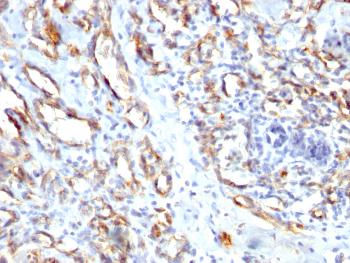 Anti-CD31 / PECAM-1 (Endothelial Cell Marker) Polyclonal Antibody