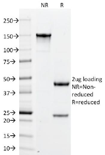 Anti-PLGF (Placental Growth Factor) Monoclonal Antibody(Clone: PLGF/94)