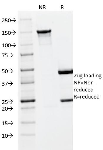 Anti-PLGF (Placental Growth Factor) Monoclonal Antibody(Clone: PLGF/93)