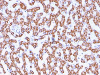 Anti-Prohibitin (Mitochondrial Marker) Monoclonal Antibody(Clone: PHB/3230)