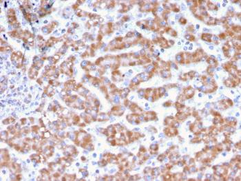 Anti-Prohibitin (Mitochondrial Marker) Monoclonal Antibody(Clone: PHB/3231)