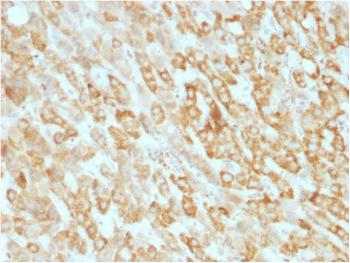 Anti-Prohibitin (Mitochondrial Marker) Monoclonal Antibody(Clone: SPM311)