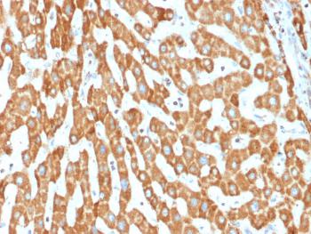 Anti-Prohibitin (Mitochondrial Marker) Monoclonal Antibody(Clone: PHB/1882)