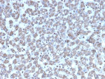 Anti-Prohibitin (Mitochondrial Marker) Monoclonal Antibody(Clone: PHB/3194)