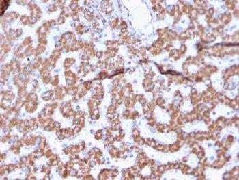 Anti-Prohibitin (Mitochondrial Marker) Monoclonal Antibody(Clone: PHB/3225)