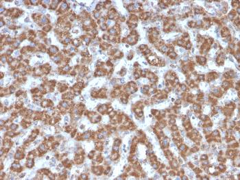 Anti-Prohibitin (Mitochondrial Marker) Monoclonal Antibody(Clone: PHB/3226)