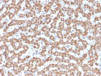 Anti-Prohibitin (Mitochondrial Marker) Monoclonal Antibody(Clone: PHB/3229)