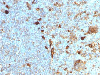 Anti-Alpha-1-Antitrypsin (SERPINA1) (Hepatocellular & Histiocytic Marker) Monoclonal Antibody(Clone: AAT/1378)