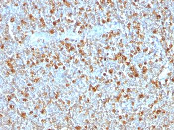 Anti-Alpha-1-Antitrypsin (SERPINA1) (Hepatocellular & Histiocytic Marker) Monoclonal Antibody(Clone: AAT/1379)