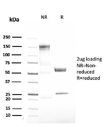 Anti-Alpha-1-Antitrypsin (SERPINA1) (Hepatocellular & Histiocytic Marker) Monoclonal Antibody(Clone: AAT/3167R)