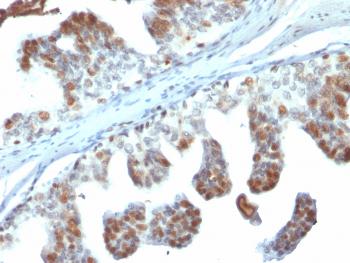 Anti-PTEN (Tumor Suppressor Oncoprotein) Monoclonal Antibody(Clone: PTEN/2110)