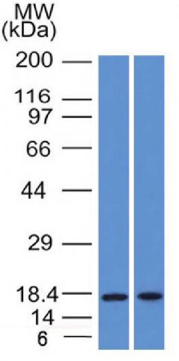 Anti-GCDFP-15 (Gross Cystic Disease Fluid Protein 15) (Breast Marker) Monoclonal Antibody(Clone: PIP/1571)