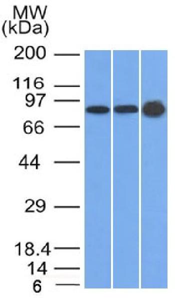 Anti-Plakophilin-1 (PKP1) Monoclonal Antibody(Clone: 10B2)