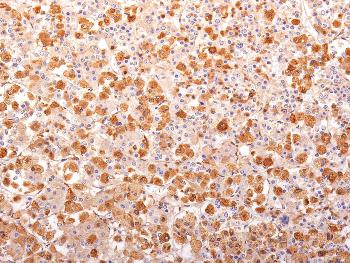 Anti-ACTH (Adrenocorticotrophic Hormone) (N-Terminal) (Pituitary Marker) Monoclonal Antibody(Clone: r57)