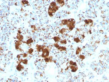 Anti-ACTH (Adrenocorticotrophic Hormone) (C-Terminal) (Pituitary Marker) Monoclonal Antibody(Clone: SPM501)