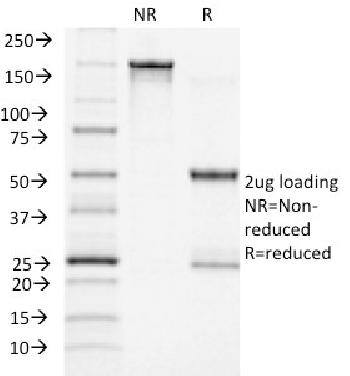 Anti-ACTH (Adrenocorticotrophic Hormone) (C-Terminus) Monoclonal Antibody(Clone: CLIP/1418)