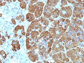 Anti-ACTH (Adrenocorticotrophic Hormone) (C-Terminus) Monoclonal Antibody(Clone: CLIP/1449)