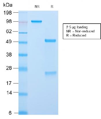 Anti-ACTH (Adrenocorticotrophic Hormone) (C-Terminus) Monoclonal Antibody(Clone: CLIP/2859R)