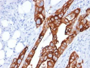 Anti-Cytokeratin 20 (KRT20) (Colorectal Epithelial Marker) Monoclonal Antibody(Clone: KRT20/1991)