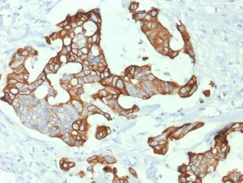 Anti-Cytokeratin 20 (KRT20) (Colorectal Epithelial Marker) Monoclonal Antibody(Clone: KRT20/1992)