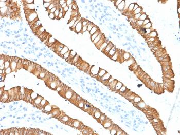 Anti-Cytokeratin 20 (KRT20) (Colorectal Epithelial Marker) Monoclonal Antibody(Clone: SPM140)