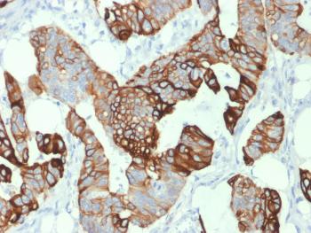 Anti-Cytokeratin 20 (KRT20) (Colorectal Epithelial Marker) Monoclonal Antibody(Clone: KRT20/1993)