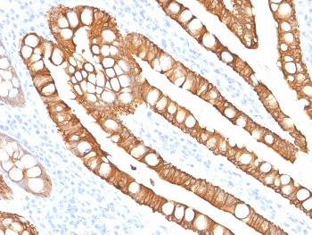 Anti-Cytokeratin 20 (KRT20) (Colorectal Epithelial Marker) Monoclonal Antibody(Clone: SPM191)