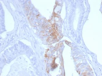 Anti-Cytokeratin 20 (KRT20) (Colorectal Epithelial Marker) Monoclonal Antibody(Clone: KRT20/3145)