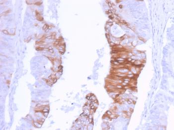 Anti-Cytokeratin 20 (KRT20) (Colorectal Epithelial Marker) Monoclonal Antibody(Clone: KRT20/3129R)