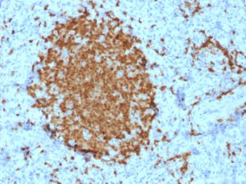 Anti-BOB.1 (B-Cell Marker) Monoclonal Antibody(Clone: BOB1/2421)