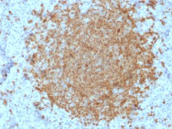 Anti-BOB.1 (B-Cell Marker) Monoclonal Antibody(Clone: BOB1/2422)