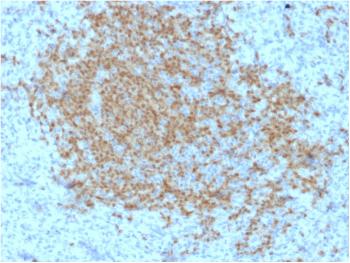 Anti-BOB.1 (B-Cell Marker) Monoclonal Antibody(Clone: BOB1/2423)