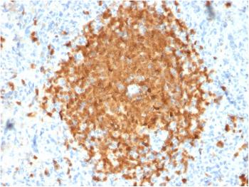 Anti-BOB.1 (B-Cell Marker) Monoclonal Antibody(Clone: BOB1/2424)