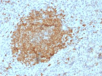 Anti-BOB.1 (B-Cell Marker) Monoclonal Antibody(Clone: BOB1/2425)