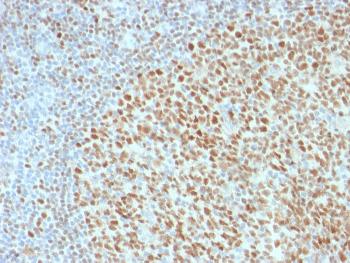 Anti-OCT-2 (POU2F2) (B-Cell Marker) Monoclonal Antibody(Clone: 86474)