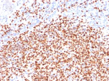 Anti-OCT-2 (POU2F2) (B-Cell Marker) Monoclonal Antibody(Clone: 86839)