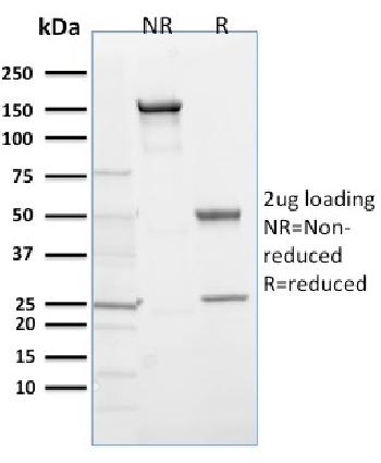 Anti-EGLN1 / PHD2 Monoclonal Antibody(Clone: 366G/76/3)