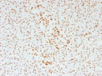 Anti-ATRX / RAD54 (Alpha Thalassemia Mental Retardation) Monoclonal Antibody(Clone: 39f)