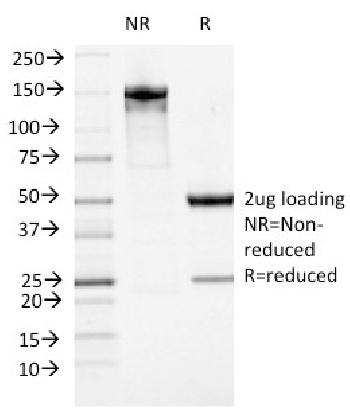 Anti-ATRX / RAD54 (Alpha Thalassemia Mental Retardation) Monoclonal Antibody(Clone: 23c)